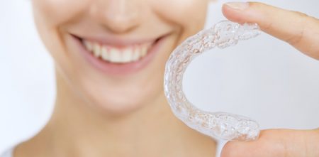 nieng-rang-invisalign-la-gi-3